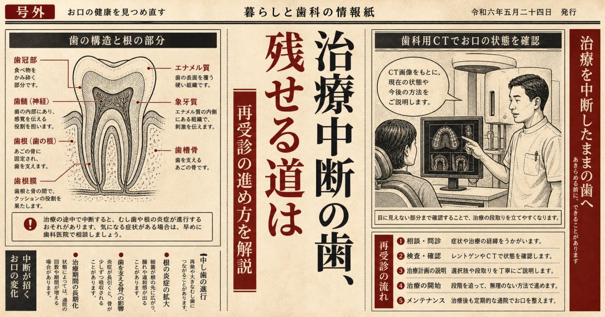 放置した根管治療は怒られる？歯を残せる可能性と再受診の進め方