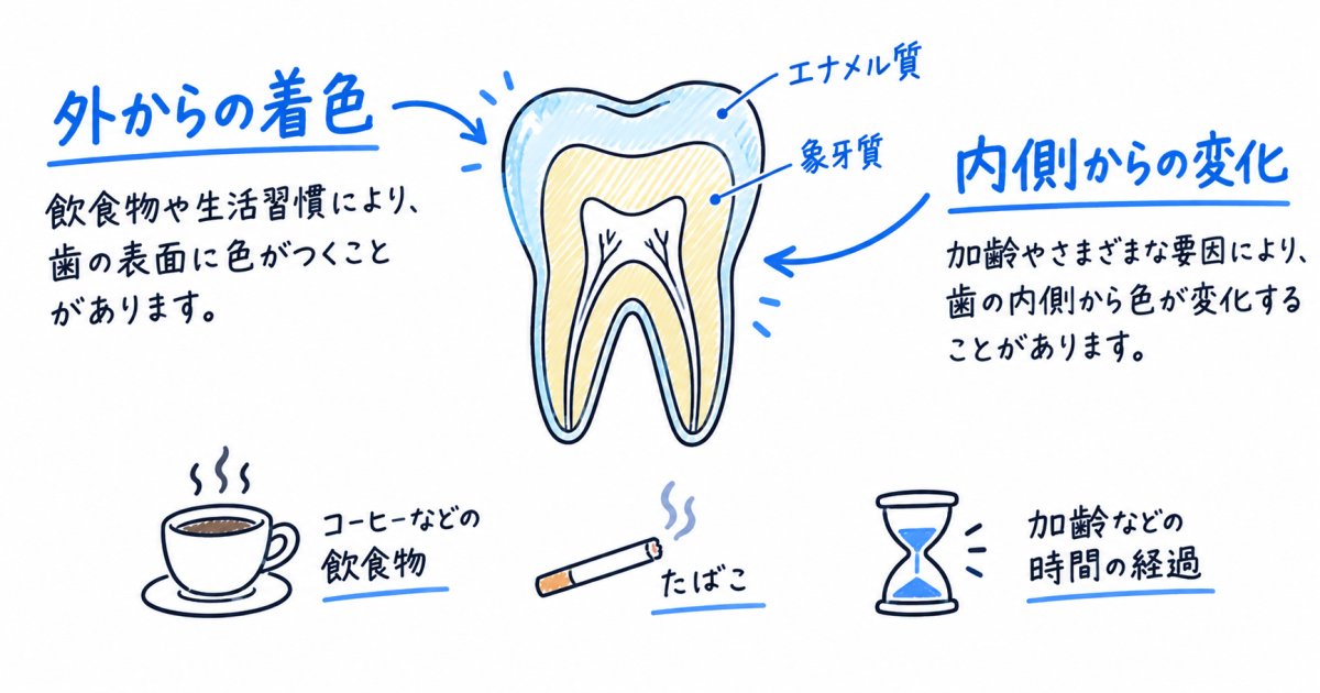 歯の黄ばみの原因はどれ?加齢・セルフケア失敗を見分ける