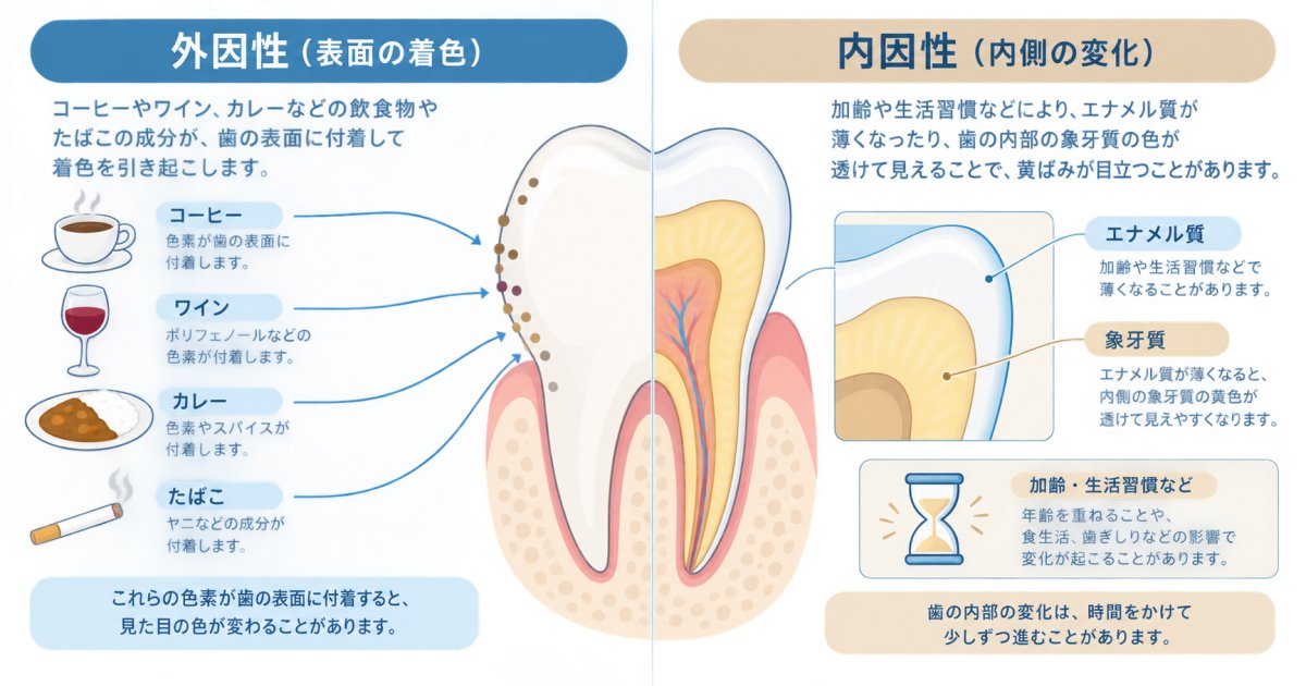 歯の黄ばみには2種類ある―外からの汚れと内側からの変化
