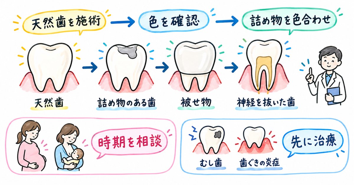 ホワイトニングができない歯の注意点と先に治療が必要な条件を整理
